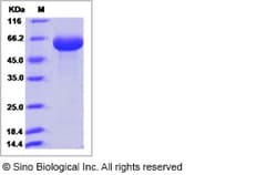 Sino Biological Human ROR1 Protein (ECD, His Tag) 100ug, Quantity: Each