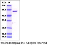 Sino Biological Recombinant Human ROR1 Protein (aa 453-783, His & GST Tag),