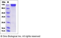 Sino Biological Human SEZ6L2 / PSK-1 Protein (His Tag) 100ug, Quantity: