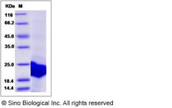 Sino Biological Recombinant Human EEF1E1 Protein (His Tag), Quantity: Each
