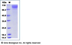 Sino Biological Human GLTP Protein (His Tag) 100ug, Quantity: Each of 1