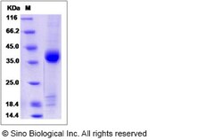 Sino Biological Recombinant Human RPRD1B Protein (His Tag), Quantity: Each