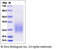 Sino Biological Recombinant Human TM4SF2/TSPAN7 Protein (His Tag), Quantity: