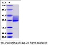 Sino Biological Human HCST / DAP10 Protein (Fc Tag) 100ug, Quantity: Each