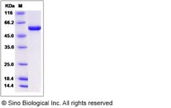 Sino Biological Recombinant Human RUVBL1 Protein (His Tag), Quantity: Each