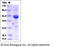 Sino Biological Recombinant Human NDRG1 Protein (His Tag), Quantity: Each