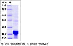 Sino Biological Human LSM1 Protein (His Tag) 100ug, Quantity: Each of 1