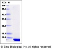 Sino Biological Recombinant Human PDRG1 Protein (His Tag), Quantity: Each