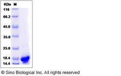 Sino Biological Recombinant Human PFDN4 Protein (His Tag), Quantity: Each