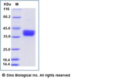 Sino Biological Recombinant Human B3GALT5 Protein (His Tag), Quantity: