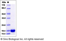 Sino Biological Human PPIL1 Protein (His Tag) 100ug, Quantity: Each of