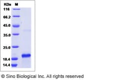 Sino Biological Recombinant Human ROM1 Protein (His Tag), Quantity: Each