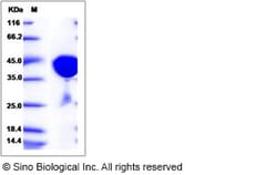 Sino Biological Recombinant Human Aspartate Aminotransferase Protein (His