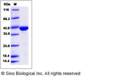 Sino Biological Recombinant Human CAPG Protein, Quantity: Each of 1