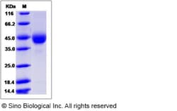 Sino Biological Human TSPAN31 Protein (Fc Tag) 100ug, Quantity: Each of