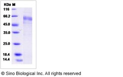 Sino Biological Human ARHI / DIRAS3 Protein (Fc Tag) 100ug, Quantity: Each