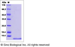 Sino Biological Recombinant Human CD81 Protein (ECD, His Tag), Quantity: