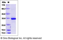 Sino Biological Human Esterase D / ESD Protein (His Tag) 100ug, Quantity: