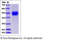 Sino Biological Recombinant Human ATP1B1 Protein (His Tag), Quantity: Each