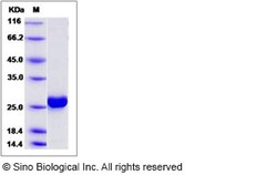 Sino Biological Recombinant Human UMP-CMP kinase/CMPK1 Protein (His Tag),