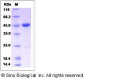 Sino Biological Recombinant Human ENO3 Protein (His Tag), Quantity: Each