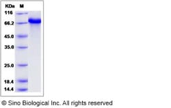 Sino Biological Recombinant Human CPNE1 Protein (SUMO Tag), Quantity: Each