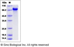Sino Biological Recombinant Human CPNE1 Protein, Quantity: Each of 1