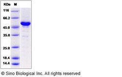 Sino Biological Human NAA10 / ARD1A Protein (His & GST Tag) 100ug, Quantity: