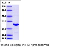 Sino Biological Recombinant Human NAA10/ARD1 Protein, Quantity: Each of