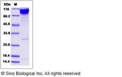 Sino Biological Human ECD / Ecdysoneless homolog Protein (His & GST Tag)