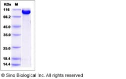 Sino Biological Recombinant Human RRM1 Protein (His & GST Tag), Quantity: