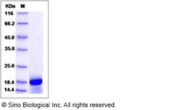 Sino Biological Recombinant Human ENSA Protein (His Tag), Quantity: Each