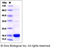 Sino Biological Human SUB1 Protein (His Tag) 100ug, Quantity: Each of 1