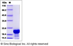 Sino Biological Recombinant Human TPPP3 Protein (His Tag), Quantity: Each