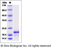 Sino Biological Recombinant Human ASF1B Protein (His Tag), Quantity: Each