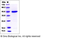 Sino Biological Recombinant Human Pleckstrin Protein (His Tag), Quantity: