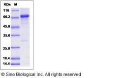 Sino Biological Human FGFR1OP / FOP Protein (His & GST Tag) 100ug, Quantity: