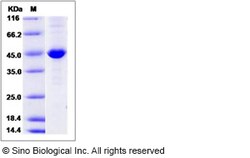 Sino Biological Human CKB / Creatine kinase B type Protein (His Tag) 50ug,
