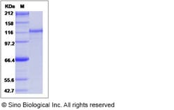 Sino Biological Recombinant Human MSH2 Protein (His & GST Tag), Quantity: