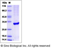 Sino Biological Recombinant Human ABHD10 Protein (aa 53-306, His Tag),