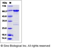 Sino Biological Recombinant Human BCCIP Protein (His & GST Tag), Quantity:
