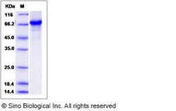 Sino Biological Recombinant Human SRFBP1 Protein (His & GST Tag), Quantity: