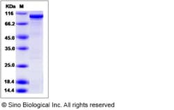 Sino Biological Recombinant Human RIOK1 Protein (His & GST Tag), Quantity:
