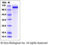 Sino Biological Human Optineurin / OPTN Protein (His & GST Tag) 100ug,