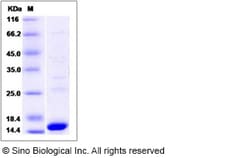Sino Biological Recombinant Human PAX8 Protein (His Tag), Quantity: Each
