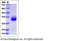 Sino Biological Human CPLX3 / Complexin 3 Protein (His Tag) 100ug, Quantity: