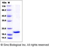Sino Biological Human SRI / Sorcin Protein 100ug, Quantity: Each of 1