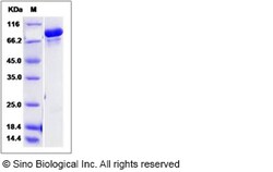Sino Biological Recombinant Human USP30 Protein (SUMO Tag), Quantity: Each