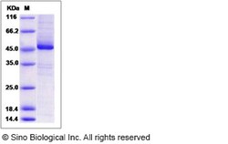 Sino Biological Human EIF3K Protein (His & GST Tag) 100ug, Quantity: Each
