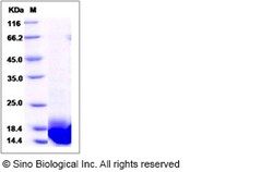 Sino Biological Recombinant Human LSM3 Protein (His Tag), Quantity: Each